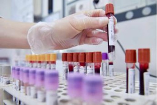 Hiv, dalla Sicilia il modello per estendere terapie long acting Hiv, dalla Sicilia il modello per estendere terapie long acting