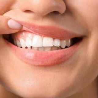 Denti a rischio tra i giovani, Sidp: "Il 36% della Gen Z ha gengive che sanguinano"
