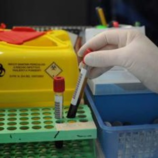 Sanità, nuovo tariffario, Medicina di laboratorio: "Oltre 70% scelte cliniche dipende da analisi" Sanità, nuovo tariffario, Medicina di laboratorio: "Oltre 70% scelte cliniche dipende da analisi"