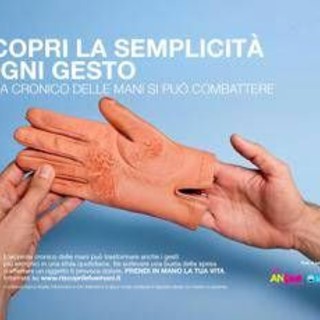Mani che bruciano e fanno male, al via campagna su eczema cronico