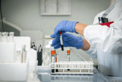 Alzheimer, test del sangue possono prevedere l'inizio dei sintomi