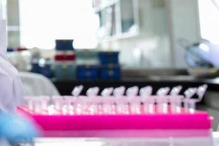 Staminali contro il Parkinson, in Giappone via libera al primo trattamento Staminali contro il Parkinson, in Giappone via libera al primo trattamento