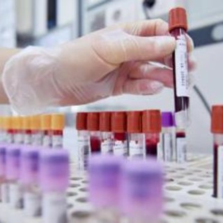 Hiv, dalla Sicilia il modello per estendere terapie long acting Hiv, dalla Sicilia il modello per estendere terapie long acting
