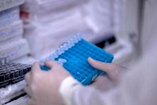 Scoperto il virus gigante Ushikuvirus, lo studio: "Può darci indizi su origine della vita" Scoperto il virus gigante Ushikuvirus, lo studio: "Può darci indizi su origine della vita"