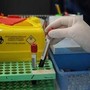 Tumori, nuovo test del sangue 'low cost' promette di scoprire diversi tipi di cancro