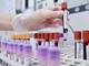 Hiv, dalla Sicilia il modello per estendere terapie long acting